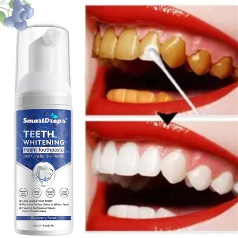 Teeth Whitening Products Online in India at Best Prices | Flipkart.com