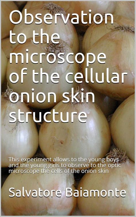 Observation to the microscope of the cellular onion skin structure ...