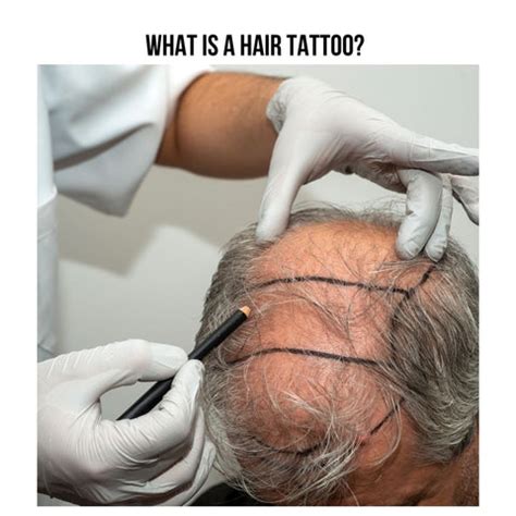 Hair Tattoo: Procedure, Costs, and Risks | Clinikally