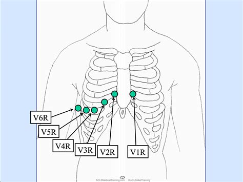 V4r Ekg 🫀12 Lead ECG Placement & The Different Versions🫀 🤔