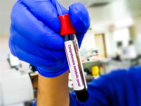 Comprehensive Metabolic Evaluation | Mullica Hill Medical, NJ