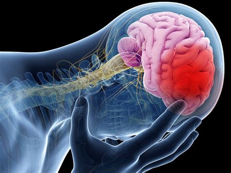 Spinal cord injury increases the risk of stroke | કરોડરજ્જુની ઇજાથી ...