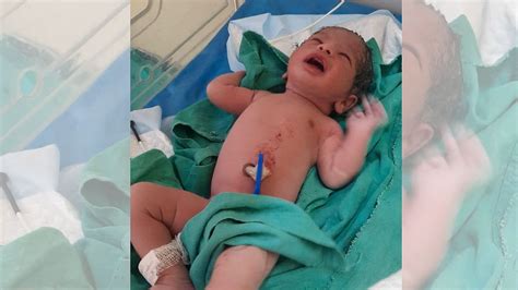 Doctors Save 37-Year-Old Mom, Baby In Rare High-Risk Twin Delivery In ...