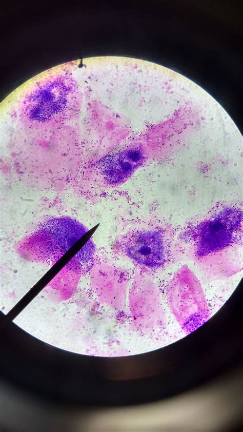 Clue Cells Gardnerella Vaginalis - NAZAEDU