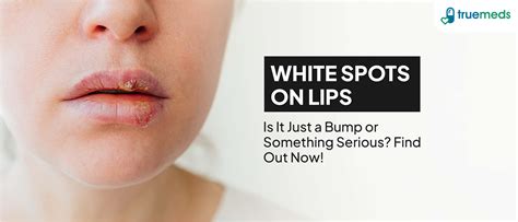 White Spots Inside Lips