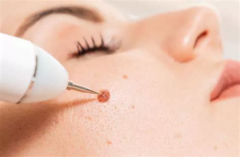Best Skin Care Clinic and Dermatologist in Changanacherry