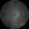 ZEISS CLARUS 500 Funduskamera