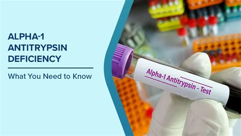 Alpha-1 Antitrypsin Deficiency (AATD): Symptoms, Causes & Risk | Max ...