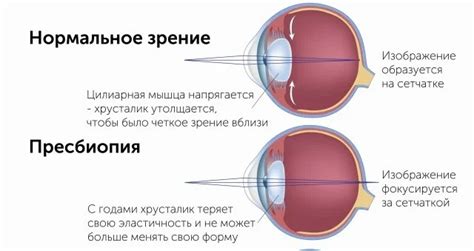 Вопрос, который интересует многих в 45-50 лет. Есть ли смысл делать ...