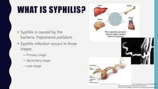 Image result for Syphilis Testing Algorithm Mayo
