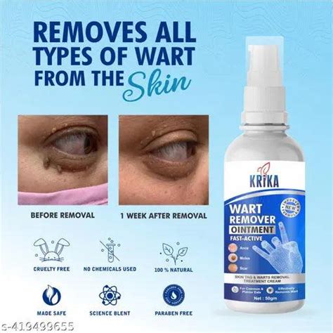 7days to Wart Remover Ointment Treatment (Pack of 01*50 GM) – Springkart