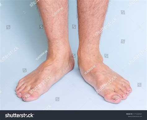 Image result for Front View of Toe