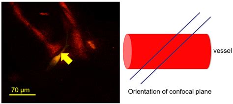 Lectin Staining of Microvascular Glycocalyx in Microfluidic Cancer Cell ...