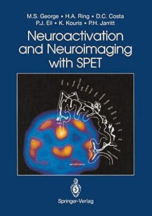 Buy Neuroactivation and Neuroimaging with SPET Book Online at Low ...
