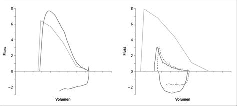 State of the Art und neue Behandlungsoptionen - Pneumologie ...