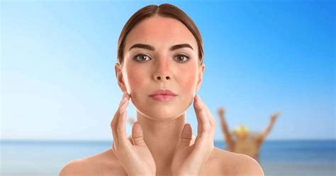 Sun Damage? Home Remedies For Sunburn | Femina.in