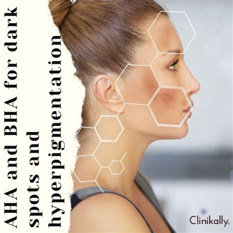 AHA vs BHA: Which Acids Should You Choose for The Skin? | Clinikally