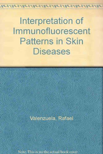Buy Interpretation of Immunofluorescent Patterns in Skin Diseases Book ...