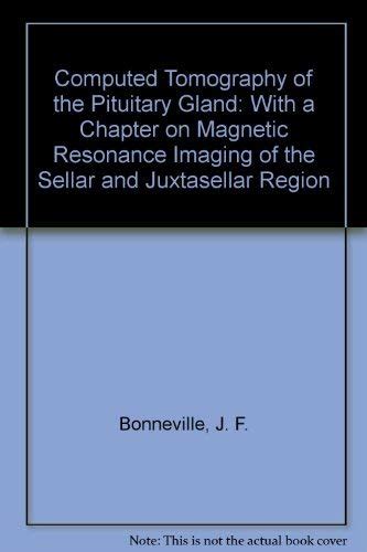Buy Computed Tomography of the Pituitary Gland: With a Chapter on ...