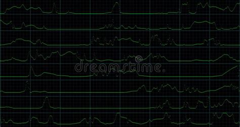 Image result for Videotape Tracking