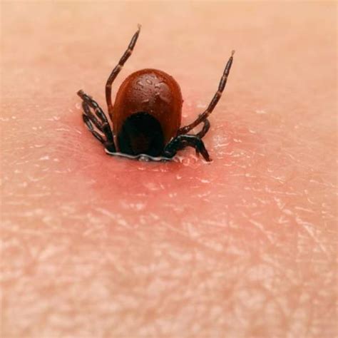 Adiós garrapatas: cómo eliminarlas de forma rápida y efectiva (y evitar ...