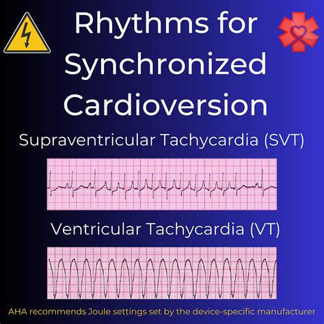 Image result for What Does Synchronized Cardioversion Do
