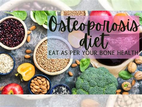 Osteoporosis Diet: 10 Foods To Help Manage Warning Symptoms ...
