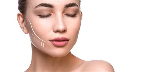 Bichectomía: Conoce cómo es la cirugía de mejillas