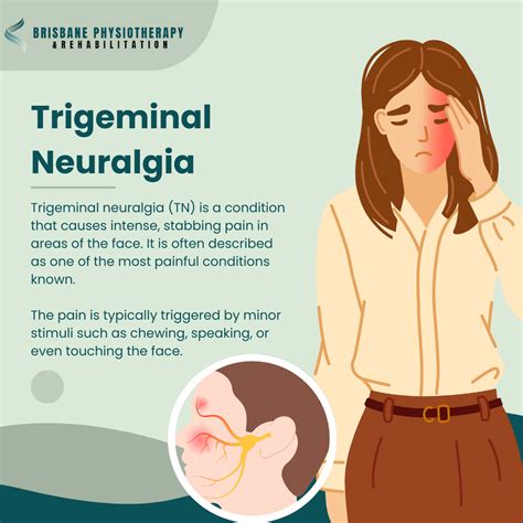 Trigeminal Neuralgia - TN - What is it? Symptoms, Causes, Treatment & Physio - Brisbane ...