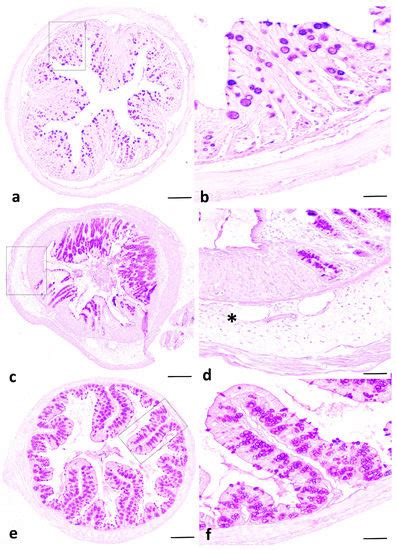Intravenous Immunoglobulin Therapy Eliminates Candida albicans and ...