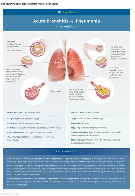 Acute Bronchitis vs Pneumonia | Dr. Kamran Ahmed (MBBS)
