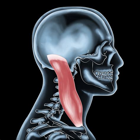 Sternocleidomastoid Muscle Exercises