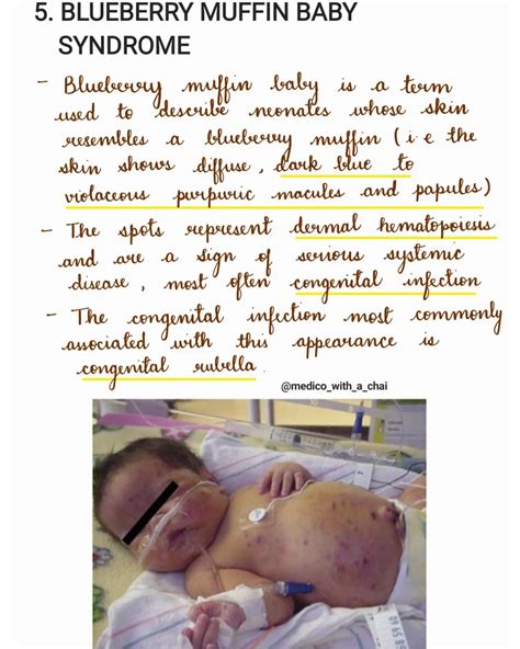 Blueberry Muffin Syndrome