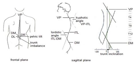 Sacral Dimple In Adults