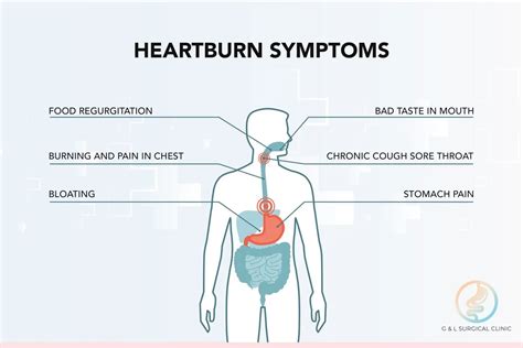 Always Suffering From Heartburn Or Acid Reflux? You May Have A ...