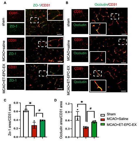 Exercise-Conditioned Endothelial Progenitor Cell-Exosomes Preserve ...