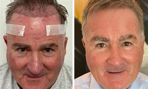 Former Sky Sports presenter Richard Keys enjoys astonishing hair ...