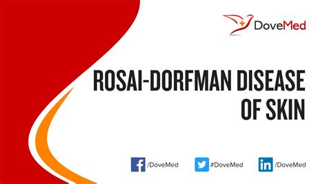 Rosai Dorfman Disease