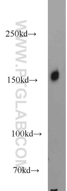 SRRM1 antibody (12822-1-AP) | Proteintech
