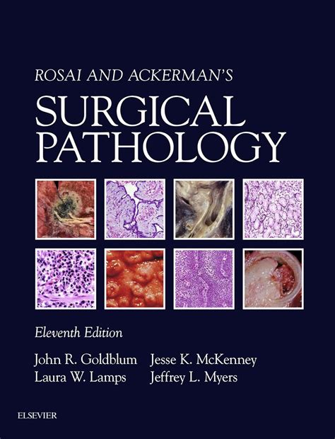 Rosai and Ackerman's Surgical Pathology eBook : Goldblum, John R ...