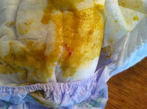 Blood In Stool Babies | Renew Physical Therapy