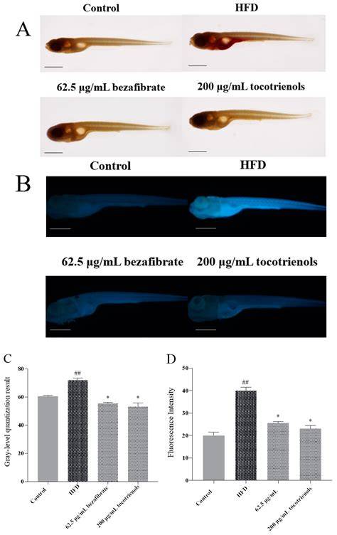 Hypolipidemic Effect of Rice Bran Oil Extract Tocotrienol in High-Fat Diet-Induced ...