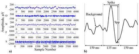 Human Emotion Recognition: Review of Sensors and Methods