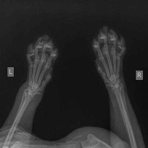 My cat is limping and his left leg swollen. Can someone read x ray ...