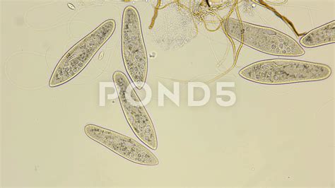 Paramecium Under Microscope Labeled