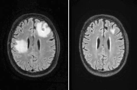 Does Soap Kill Brain Eating Amoeba at Caitlin Hume blog