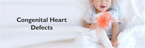 Congenital heart defects: Causes, Symptoms & Treatment
