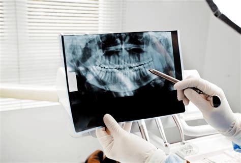 How Much Do Dental X-Rays Cost? | Take an Estimate