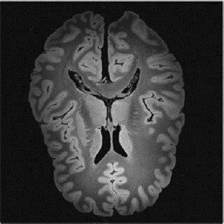 High Res Brain Scan Image 的图像结果