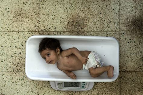 Starving kids pack hospital wards: Capturing Afghanistan's hunger ...